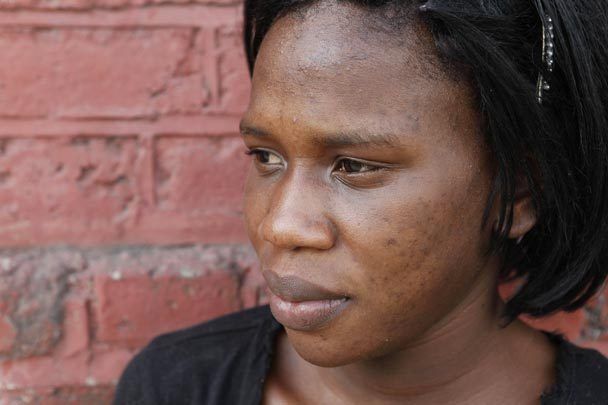 Skin bleaching a growing problem in Jamaica slums The Seattle Times