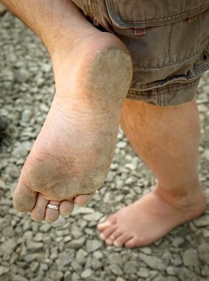 Bare foot of western tourist after trekking with hiking boots in