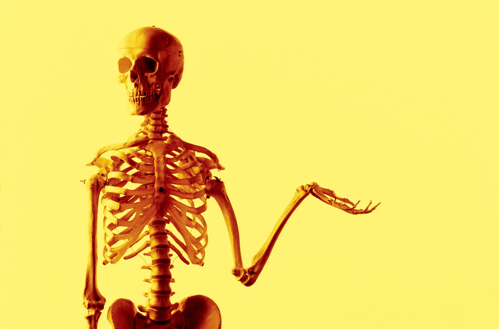 Generic celebrex online