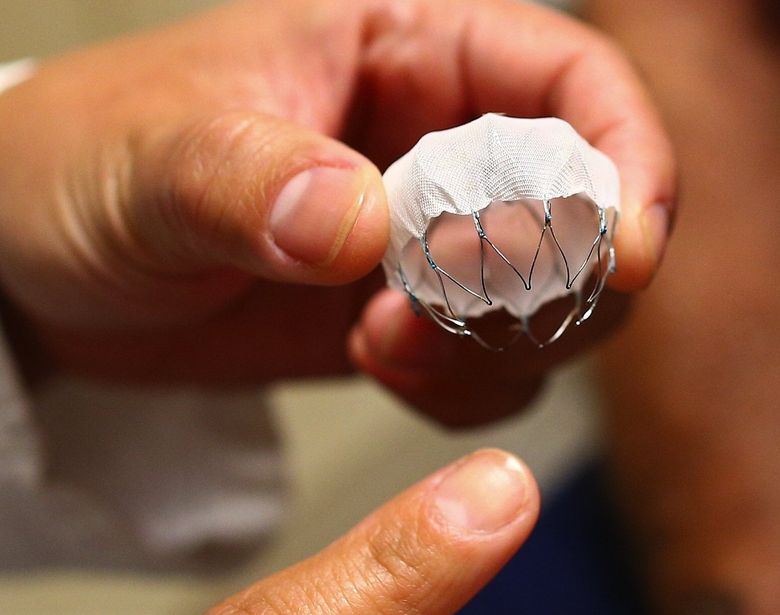 UW among first to implant stroke-fighting heart device | The Seattle Times