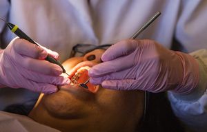 Dr. Rachel Hogan working with patient Nina Cladoosby at the Swinomish Tribal clinic in La Conner. Dr. Hogan supports the training of dental health aids called DHAT’s to work at the clinic.