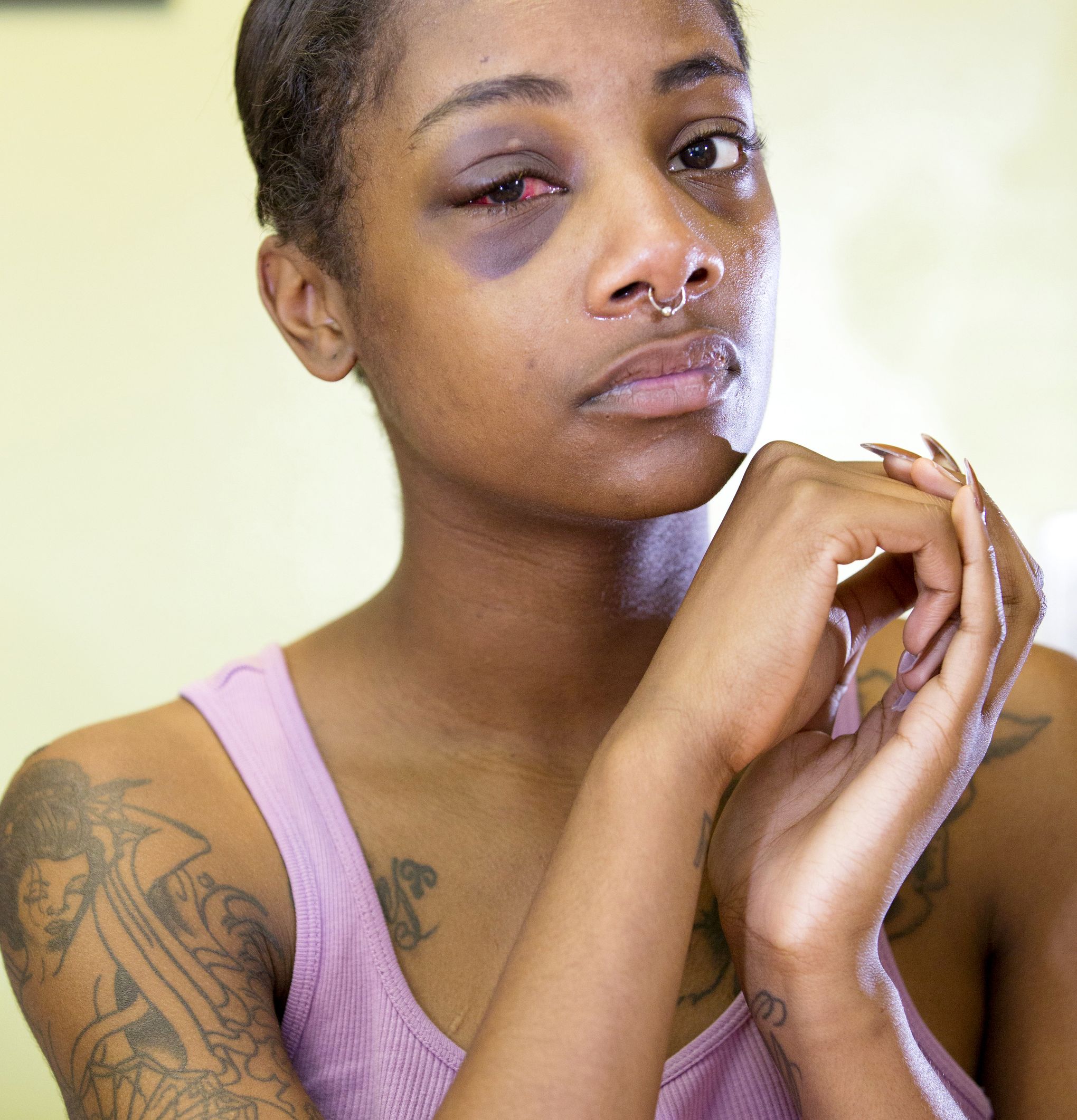 Woman Punched By Seattle Cop Settles Civil Suit For 195000 The Seattle Times