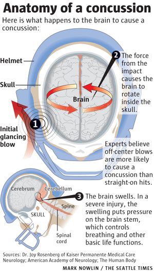 The Zero1 Flexible Football Helmet May Save Players' Brains