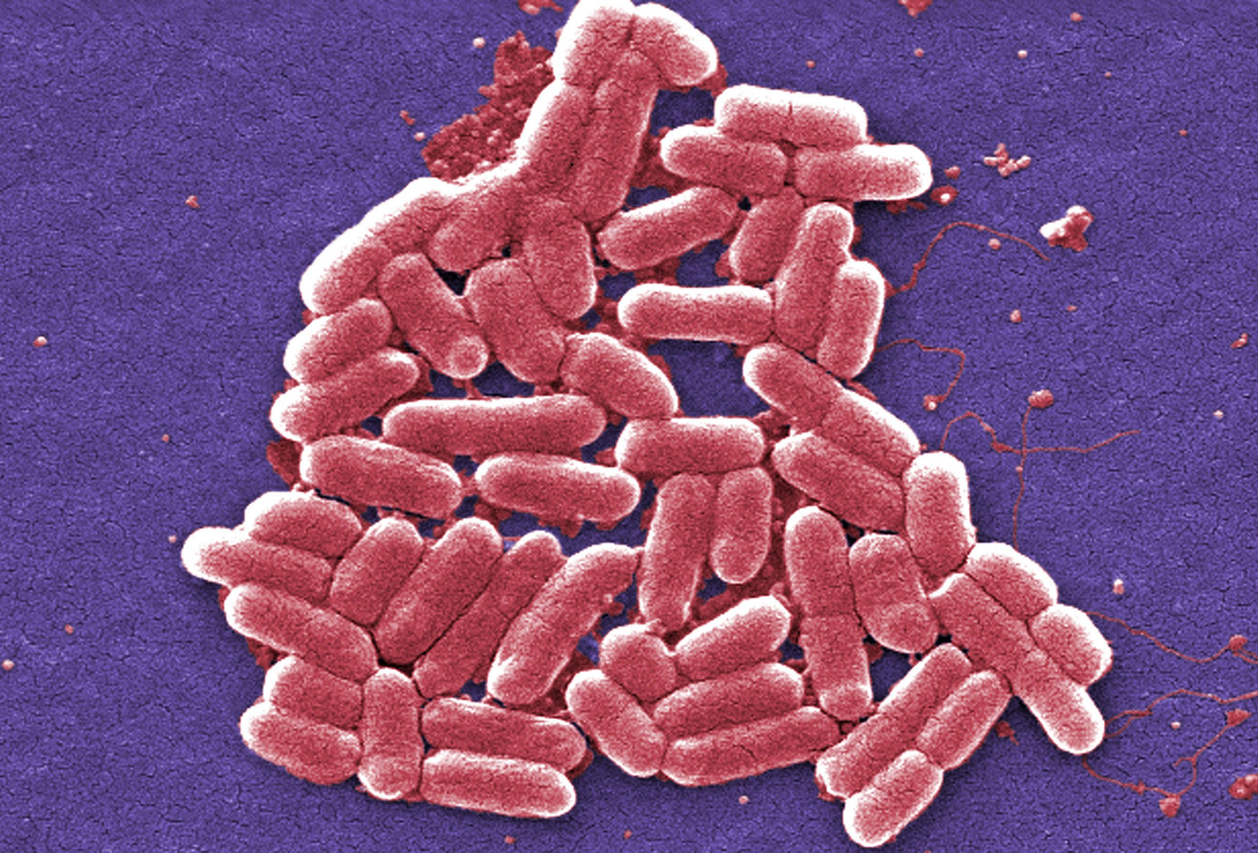 Post-antibiotic world'? U.S. patient's infection resistant to all