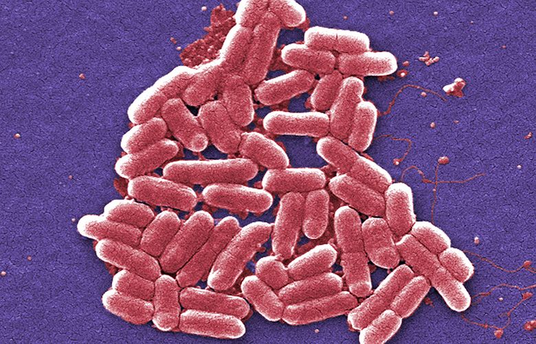 ‘Postantibiotic world’? U.S. patient’s infection resistant to all