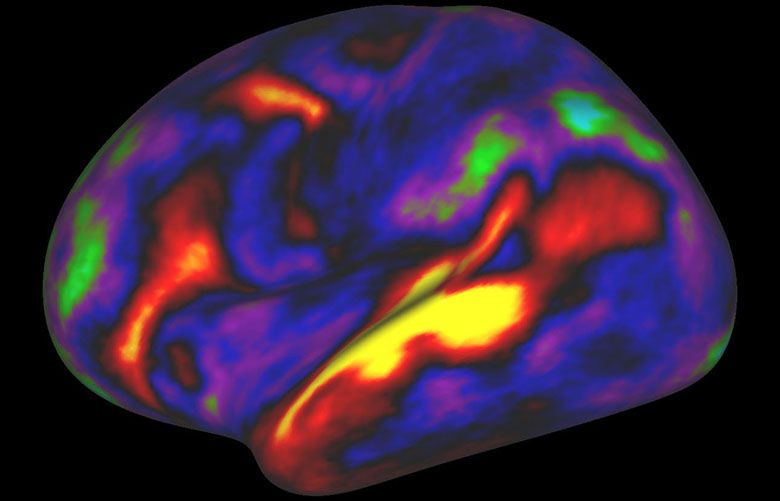 Updated brain map identifies nearly 100 new regions | The Seattle Times