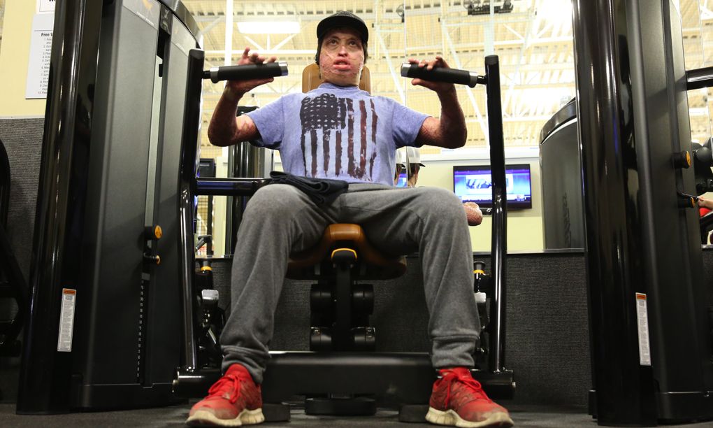 After the fire, Lyon lost 40 pounds. He’s regained some, but he hopes to build back up to his firefighting weight of 174 pounds. He can’t get too bulky, he says, or the muscles will stretch his scars. (Ken Lambert/The Seattle Times)