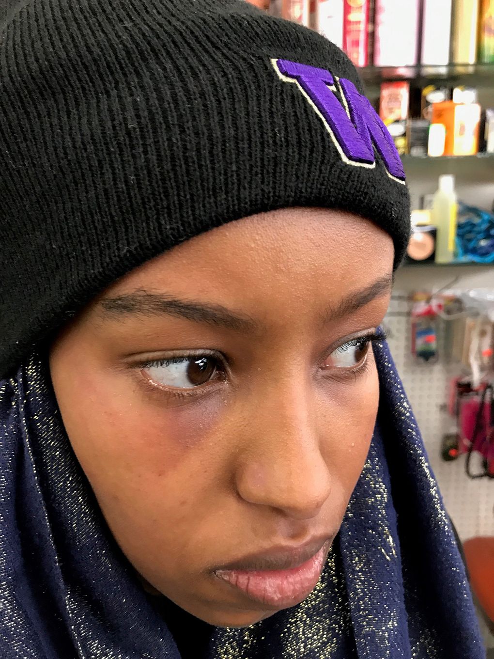 Nasro Hassan, a 19-year-old UW freshman, was struck in the face with a bottle by a male just before 5 p.m. on Nov. 15 as she walked along Grant Lane, where it runs between Mary Gates Hall and Suzzallo Library. (Courtesy Nasro Hassan)
