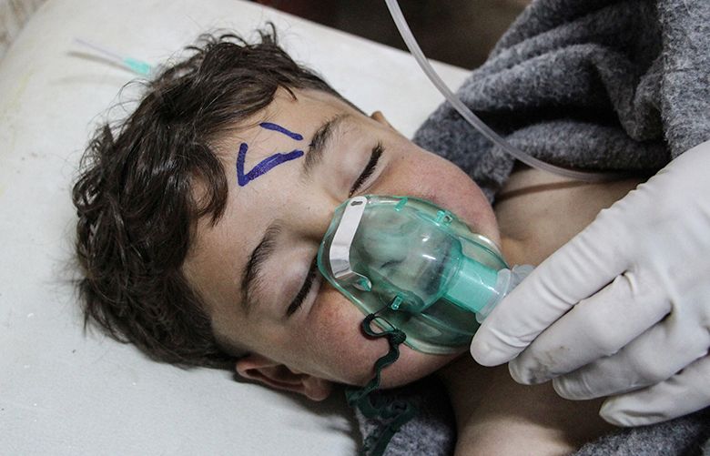 epaselect epa05887418 A Syrian child receives treatment after an alleged chemical attack at a field hospital in Saraqib, Idlib province, northern Syria, 04 April 2017. Media reports quoting the British war monitor Syrian Observatory for Human Rights state an alleged chemical attack in the rebel-held area of Idlib province on 04 April killed at least 58 people, including 11 minors, and wounded dozens others.  EPA/STRINGER