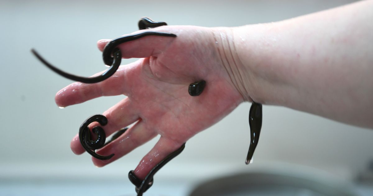 Leeches are still used in medicine—yes, really. Here's why.