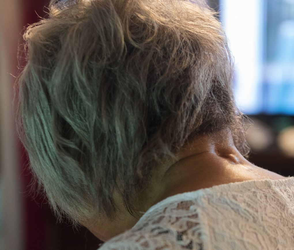The back of Phyllis Johnson’s neck shows scars from her surgery. She has trouble walking, and her family props her up with pillows at bedtime because she can’t lie down flat. (Steve Ringman/The Seattle Times)