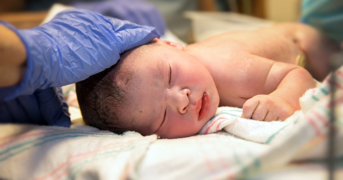 After surgery in the womb, a baby kicks up hope | The Seattle Times