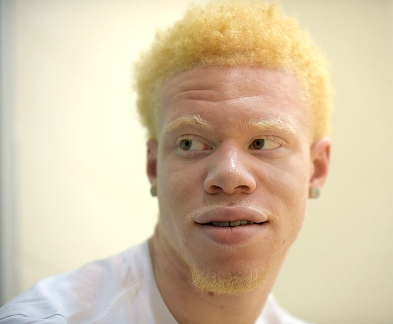 african albino model