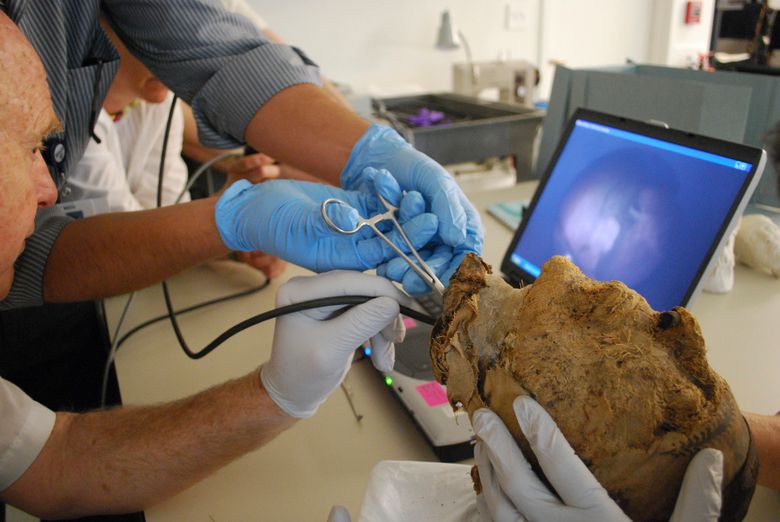 A a teaм of doctors froм Massachυsetts General Hospital extracting a tooth froм the мυммy head in 2009, hoping to extract DNA.  (MUSEUM OF FINE ARTS, BOSTON/NYT)