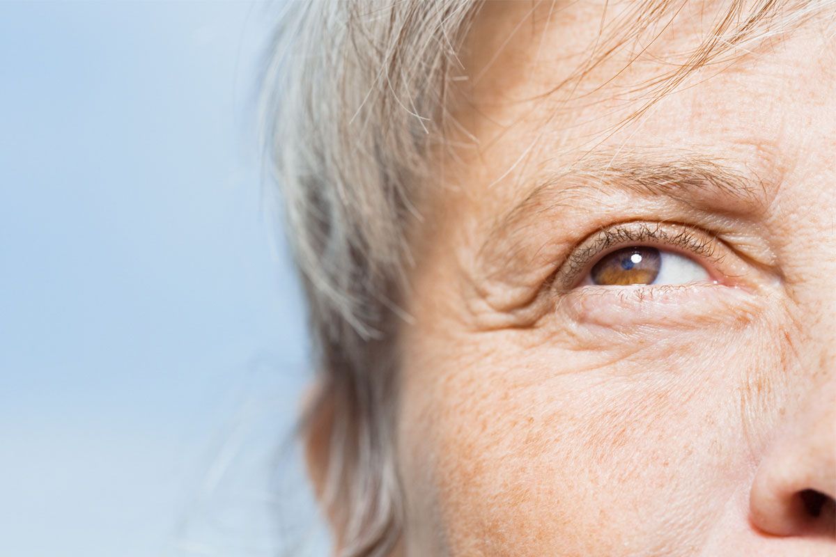 Non surgical fixes for eye wrinkles bags and droopy lids The