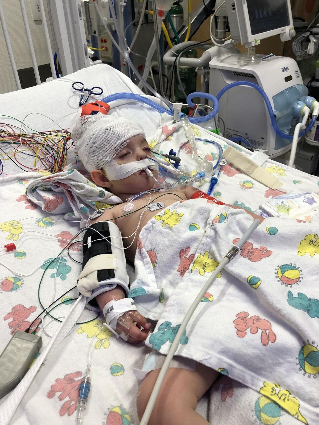 Luca Wade, diagnosed with Wolf-Hirschhorn syndrome, had a severe seizure in May that caused partial paralysis of one side of her body. Her mother, Leah Wade, describes the 3-year-old as “pure joy.” (Leah Wade)