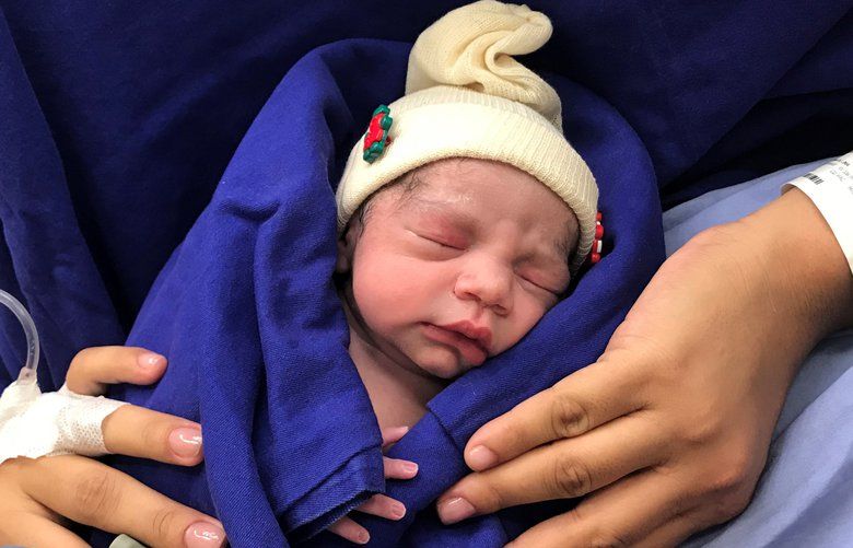 This Dec. 15, 2017 photo provided by transplant surgeon Dr. Wellington Andraus shows the baby girl born to a woman with a uterus transplanted from a deceased donor at the Hospital das Clinicas of the University of Sao Paulo School of Medicine, Sao Paulo, Brazil, on the day of her birth. Nearly a year later, mother and baby are both healthy. (Courtesy Dr. Wellington Andraus via AP) NYSP101 NYSP101