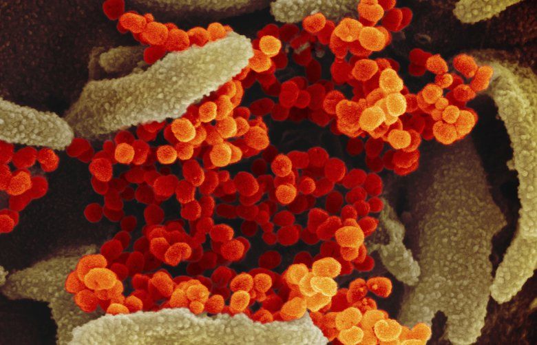 This undated electron microscope image made available by the U.S. National Institutes of Health in February 2020 shows the Novel Coronavirus SARS-CoV-2, orange, emerging from the surface of cells, green, cultured in the lab. Also known as 2019-nCoV, the virus causes COVID-19. The sample was isolated from a patient in the U.S. (NIAID-RML via AP) ny407 ny407