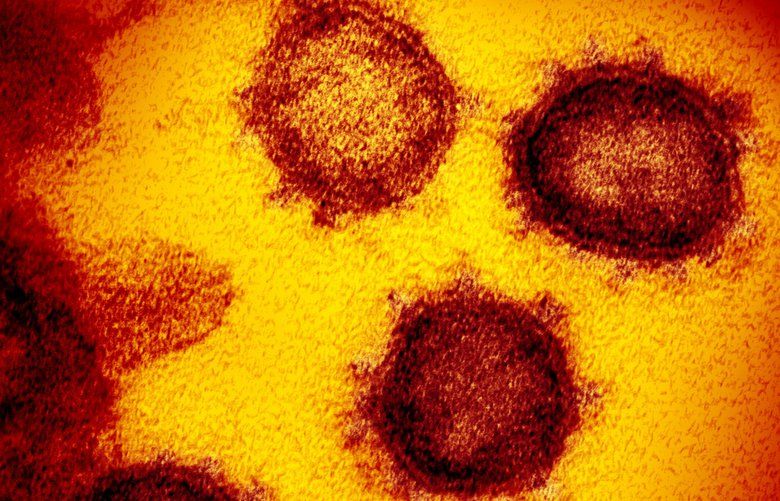 FILE – This undated electron microscope image made available by the U.S. National Institutes of Health in February 2020 shows the Novel Coronavirus SARS-CoV-2. Also known as 2019-nCoV, the virus causes COVID-19. The sample was isolated from a patient in the U.S. On Tuesday, April 21, 2020, U.S. health regulators OK’d the first coronavirus test that allows people to collect their own sample at home, a new approach that could help expand testing options in most states. The sample will still have to be shipped for processing back to LabCorp, which operates diagnostic labs throughout the U.S. (NIAID-RML via AP) NY551 NY551