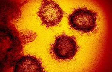 FILE – This undated electron microscope image made available by the U.S. National Institutes of Health in February 2020 shows the Novel Coronavirus SARS-CoV-2. Also known as 2019-nCoV, the virus causes COVID-19. The sample was isolated from a patient in the U.S. On Friday, Feb. 21, 2020, The Associated Press reported on a video circulating online incorrectly asserting that man in Wuhan, China, was sanitizing his apartment with alcohol when the air conditioner came on and caused an explosion and fire. The fire captured on video was the result of a cigarette that was improperly put out on a comforter. The comforter then ignited and was placed on a balcony where nearby debris caught fire in Chongqing, China, a city hundreds of miles away from Wuhan. (NIAID-RML via AP) NYNR303 NYNR303