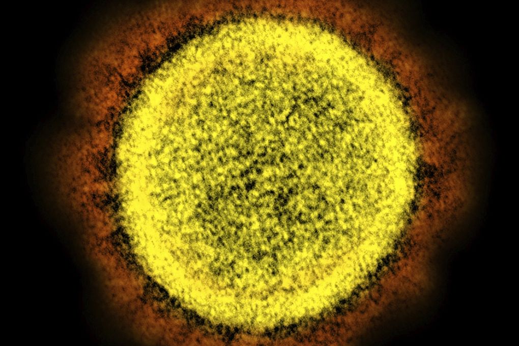 This 2020 electron microscope image made available by the National Institute of Allergy and Infectious Diseases shows a novel coronavirus particle. Officials in Olympia on Wednesday released the criteria that they will use to distribute a vaccine for the virus, once one is developed. (NIAID/NIH via AP)