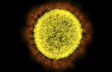 This 2020 electron microscope image made available by the National Institute of Allergy and Infectious Diseases shows a novel coronavirus SARS-CoV-2 particle isolated from a patient, in a laboratory in Fort Detrick, Maryland. (NIAID/NIH via AP)