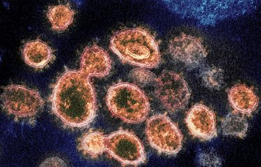 FILE – This 2020 electron microscope image provided by the National Institute of Allergy and Infectious Diseases – Rocky Mountain Laboratories shows SARS-CoV-2 virus particles which causes COVID-19, isolated from a patient in the U.S., emerging from the surface of cells cultured in a lab. On Monday, Oct. 5, 2020, the top U.S. public health agency said that coronavirus can spread greater distances through the air than 6 feet, particularly in poorly ventilated and enclosed spaces. But agency officials continued to say such spread is uncommon, and current social distancing guidelines still make sense. (NIAID-RML via AP) NY869