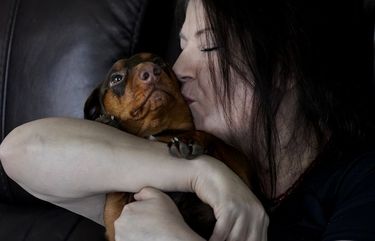 Double lung transplant recipient Kari Wegg kisses her dachshund, Maisie, in her home in Westfield, Ind., Monday, March 22, 2021. The Indiana nurse came down with COVID-19 in the summer of 2020; her condition spiraled downward, and her life was saved only by grace of a double lung transplant. The road to normal is a long one, but she’s bolstered by the love and support of her husband and sons, and by her own indomitable spirit. (AP Photo/Charles Rex Arbogast) INCA514 INCA514