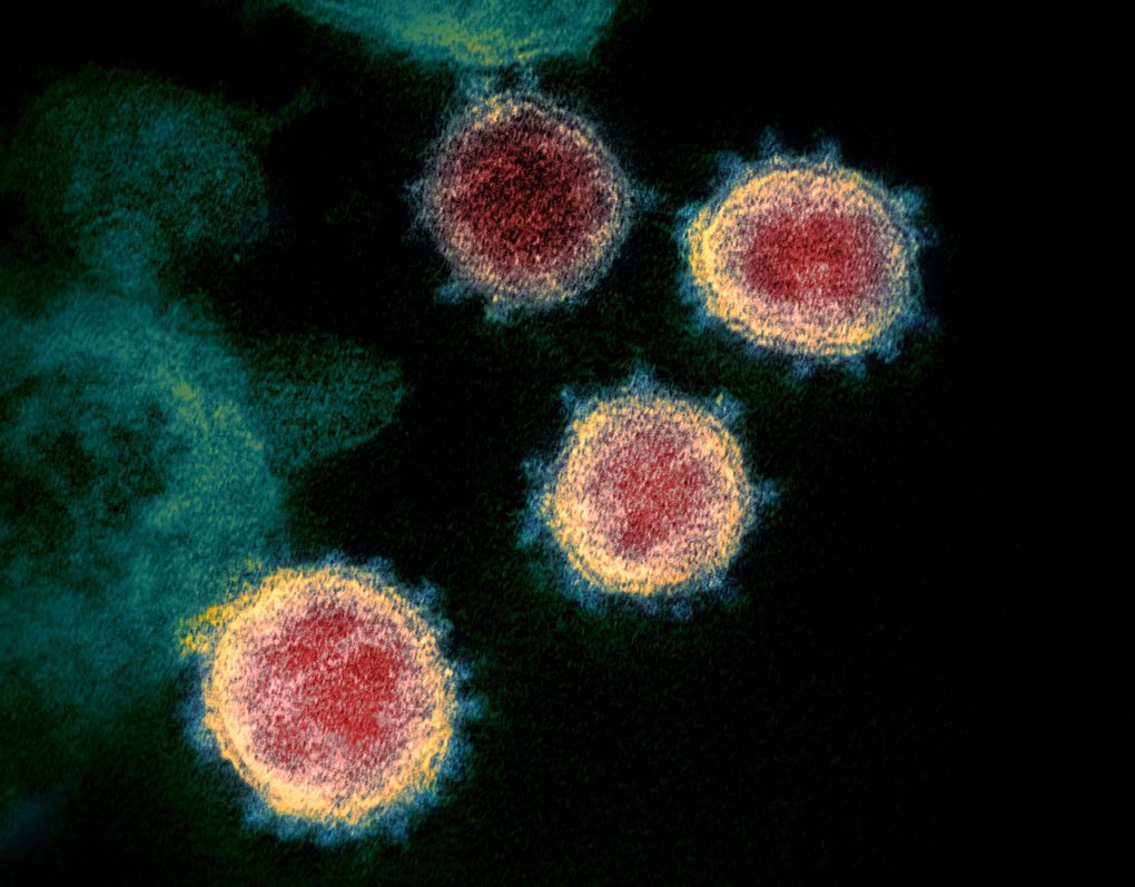 This electron microscope image made available by the National Institutes of Health in February 2020 shows the virus that causes COVID-19. Scientists have found that the coronavirus that causes COVID-19 is capable of infecting two types of brain cells — neurons and astrocytes.(NIAID-RML via AP, file)