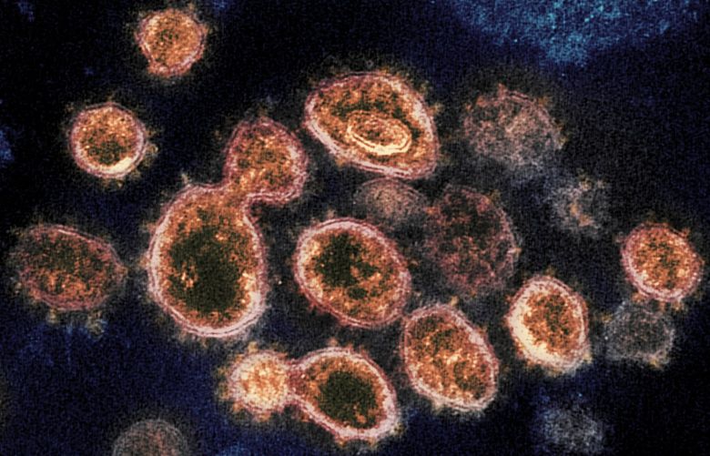 FILE – This 2020 electron microscope image provided by the National Institute of Allergy and Infectious Diseases – Rocky Mountain Laboratories shows SARS-CoV-2 virus particles which cause COVID-19, isolated from a patient in the U.S., emerging from the surface of cells cultured in a lab. Viruses are constantly mutating, with coronavirus variants circulating around the globe. (NIAID-RML via AP)