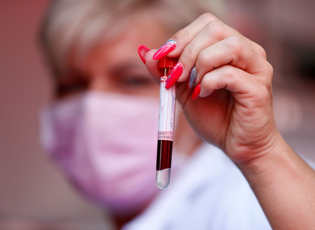 A staff member displays blood she’s taken from an elderly patient for an antibody test in Budapest, Thursday , July 8, 2021. Hungary’s capital city is offering free antibody testing to its elderly residents, a bid to pressure the central government to take action over concerns that certain COVID-19 vaccines do not provide adequate protection against the virus. (AP Photo/Laszlo Balogh)