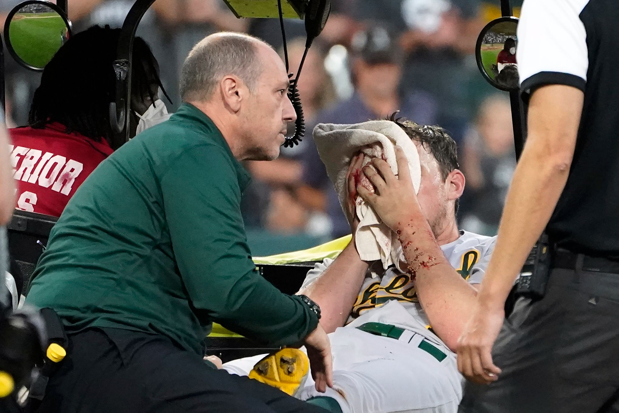 Photos: A's Bassitt returns to mound weeks after being hit in face with  line drive