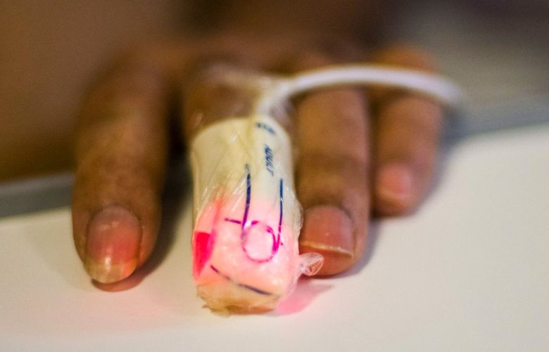 A fingertip pulse oximeter on a Covid-19 patient in the intensive care unit (ICU) at the Ambroise Pare Clinic in Paris, France, on Thursday, Oct. 22, 2020. The resurgence of the coronavirus has dragged Franceâ€™s economy back into a slump, cutting short the recovery from the lockdown recession. Photographer: Nathan Laine/Bloomberg 775580758