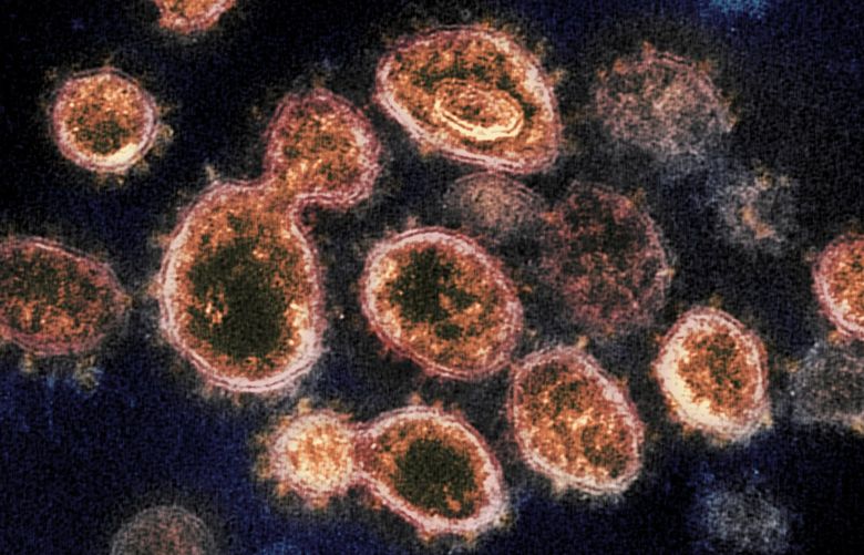 FILE – This 2020 electron microscope image provided by the National Institute of Allergy and Infectious Diseases – Rocky Mountain Laboratories shows SARS-CoV-2 virus particles which cause COVID-19, isolated from a patient in the U.S., emerging from the surface of cells cultured in a lab. According to a study released in The Lancet Global Health on Wednesday, Oct. 27, 2021, Fluvoxamine, a cheap antidepressant, reduced the need for hospitalization among high-risk adults with COVID-19. (NIAID-RML via AP) NY500 NY500