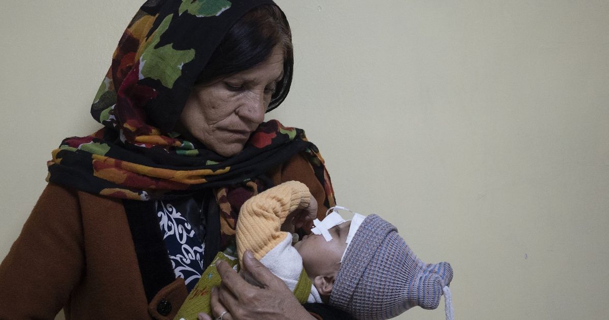 Emaciated Children In Kabul Hospital Point To Rising Hunger The