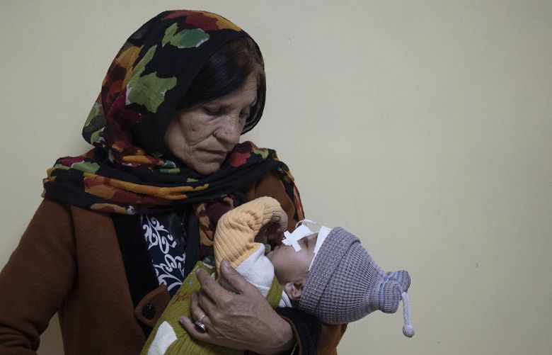 Simien Arian holds her malnourished nine-month-old grandchild Maaz in the Indira Gandhi hospital in Kabul, Afghanistan, Monday, Nov. 8, 2021. The number of people living in Afghanistan in near-famine conditions has risen to 8.7 million according to the World Food Program. (AP Photo/Bram Janssen) XBJ103 XBJ103