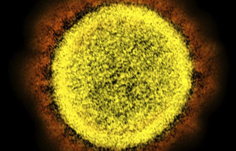 FILE – This 2020 electron microscope image made available by the National Institute of Allergy and Infectious Diseases shows a Novel Coronavirus SARS-CoV-2 particle isolated from a patient, in a laboratory in Fort Detrick, Md. Coronaviruses, including the newest one, are named for the spikes that cover their outer surface like a crown, or corona in Latin. Using those club-shaped spikes, the virus latches on to the outer wall of a human cell, invades it and replicates, creating viruses to hijack more cells. (NIAID/NIH via AP)