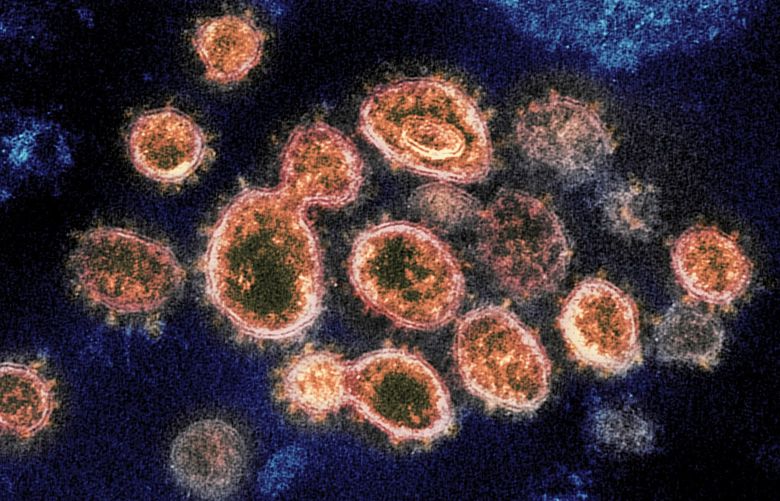 FILE – This 2020 electron microscope image provided by the National Institute of Allergy and Infectious Diseases – Rocky Mountain Laboratories shows SARS-CoV-2 virus particles which causes COVID-19, isolated from a patient in the U.S., emerging from the surface of cells cultured in a lab. On Monday, Oct. 5, 2020, the top U.S. public health agency said that coronavirus can spread greater distances through the air than 6 feet, particularly in poorly ventilated and enclosed spaces. But agency officials continued to say such spread is uncommon, and current social distancing guidelines still make sense. (NIAID-RML via AP) NY869