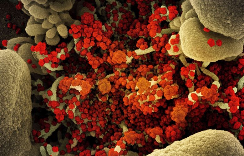 A lot remains a mystery about omicron, which has more than twice the number of mutations as the delta variant, with the bulk found in the spike, the crown-like protein on the surface of the virus that vaccines train our bodies to attack. This colorized scanning electron micrograph of a cell heavily infected with SARS-CoV-2 virus particles (orange/red) was captured at the NIAID Integrated Research Facility (IRF) in 2020. (NIAID via ZUMA Wire/TNS) 33961527W 33961527W
