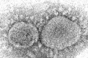 FILE – This 2020 electron microscope image made available by the Centers for Disease Control and Prevention shows SARS-CoV-2 virus particles which cause COVID-19. The World Health Organization has appointed an independent scientific panel to advise on whether vaccine shots need reformulating because of omicron or any other mutant. (Hannah A. Bullock, Azaibi Tamin/CDC via AP, File)