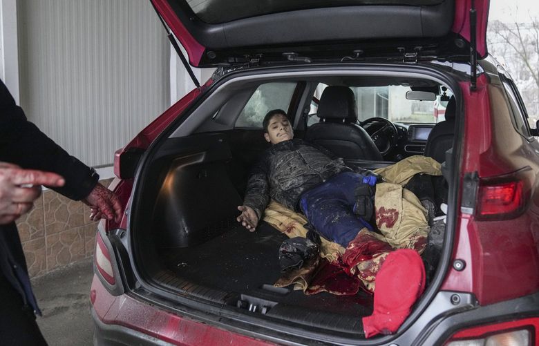 Teenager Artyom, 15, wounded by shelling, lies in a car waiting to be moved to a maternity hospital converted into a medical ward in Mariupol, Ukraine, Wednesday, March 2, 2022. (AP Photo/Evgeniy Maloletka) NYAG307 NYAG307