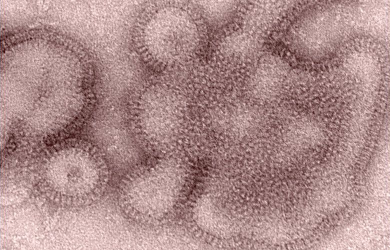 This 2011 image provided by the Centers for Disease Control and Prevention shows an H3N2 influenza virus _ the same type of flu that’s responsible for most flu illnesses this winter. A new study shows that this year’s flu vaccine is only 23 percent effective, mainly because it isn’t well matched to the H3N2 strain that’s spread across the country. (AP Photo/Centers for Disease Control and Prevention, Dr. Michael Shaw, Doug Jordan)