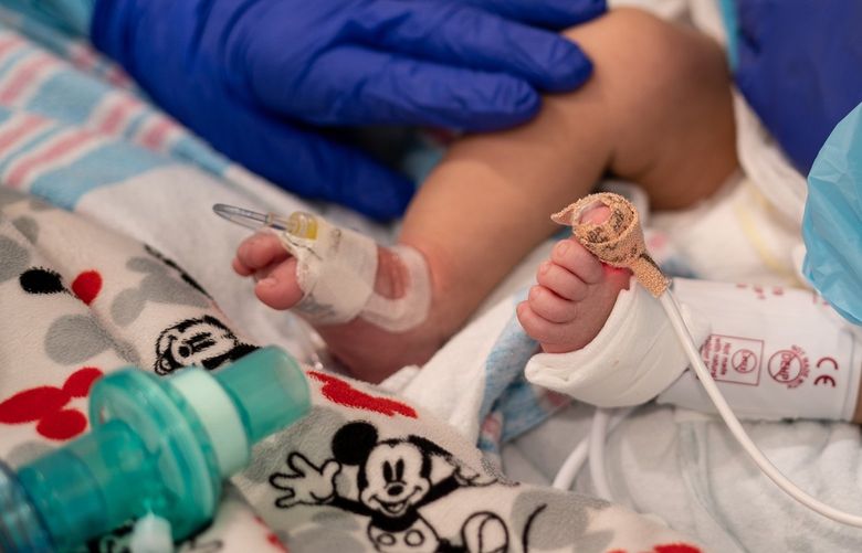 FILE — Hospital staff with a two-month-old about to be placed on a ventilator following complications of COVID-19 at Children’s Hospital in New Orleans, Aug. 20, 2021. Babies and children younger than age 5 were hospitalized with coronavirus at much higher rates during the latest U.S. surge, when the highly transmissible Omicron variant was dominant, compared with earlier periods in the pandemic, according to the Centers for Disease Control and Prevention. (Erin Schaff/The New York Times) XNYT37 XNYT37