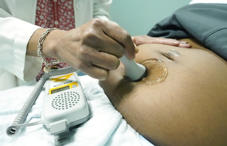 Dr. Felecia Brown, a midwife at Sisters in Birth, a Jackson, Miss., clinic that serves pregnant women, left, uses a hand held doppler probe on Kamiko Farris of Yazoo City, to measure the heartbeat of the fetus, Dec. 17, 2021. The clinic utilizes an integrative and holistic approach to women’s healthcare by providing comprehensive services including primary care, midwifery care, home healthcare, childbirth education as well as doula support. (AP Photo/Rogelio V. Solis)