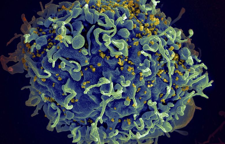 FILE – This colorized electron microscope image made available by the U.S. National Institutes of Health shows a human T cell, indicated in blue, under attack by HIV, in yellow, the virus that causes AIDS. In a study released in the journal Nature on Thursday, April 28, 2022, climate change will result in thousands of new viruses spread among animal species by 2070, which is likely to increase the risk of emerging infectious diseases jumping from animals to humans. (Seth Pincus, Elizabeth Fischer, Austin Athman/National Institute of Allergy and Infectious Diseases/NIH via AP) NY457 NY457