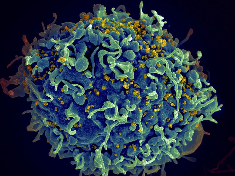 这张由美国国立卫生研究院提供的彩色电子显微镜图像显示了一个人体 T 细胞，用蓝色表示，正受到 HIV 的攻击，黄色表示导致艾滋病的病毒。 2022 年 4 月 28 日星期四发表在《自然》杂志上的一项研究称，到 2070 年，气候变化将导致数千种新病毒在动物物种中传播，这可能会增加新出现的传染病传染给人类的风险。 （Seth Pincus、Elizabeth Fischer、Austin Athman / National Institute of Allergy and Infectious Diseases / NIH via AP）