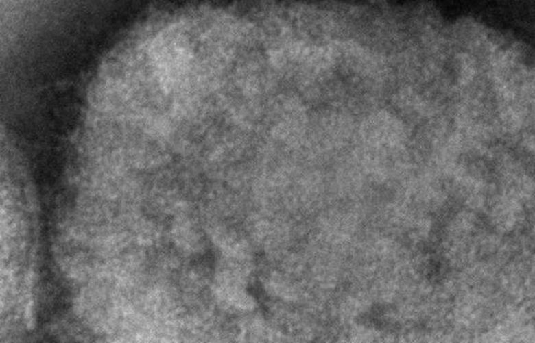 This 2003 electron microscope image made available by the Centers for Disease Control and Prevention shows a monkeypox virion, obtained from a sample associated with the 2003 prairie dog outbreak. On Wednesday, May 18, 2022, Massachusetts has reported a rare case of monkeypox in a man who recently had traveled to Canada, and investigators are looking into whether it is connected to recent cases in Europe. (Cynthia S. Goldsmith, Russell Regner/CDC via AP) NY816 NY816