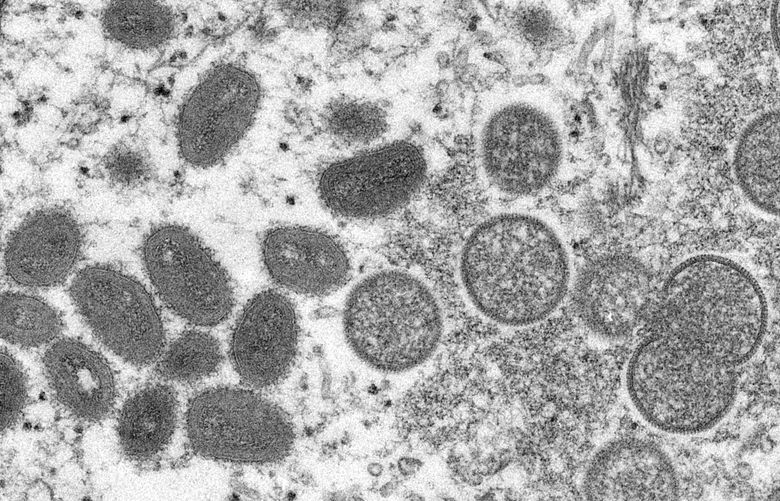 This 2003 electron microscope image made available by the Centers for Disease Control and Prevention shows mature, oval-shaped monkeypox virions, left, and spherical immature virions, right, obtained from a sample of human skin associated with the 2003 prairie dog outbreak. On Wednesday, May 18, 2022, Portuguese health authorities confirmed five cases of monkeypox in young men, marking an unusual outbreak in Europe of a disease typically limited to Africa. (Cynthia S. Goldsmith, Russell Regner/CDC via AP) NY815 NY815