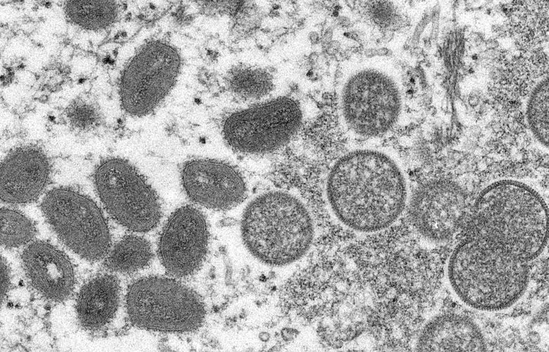 FILE – This 2003 electron microscope image made available by the Centers for Disease Control and Prevention shows mature, oval-shaped monkeypox virions, left, and spherical immature virions, right, obtained from a sample of human skin associated with the 2003 prairie dog outbreak. A leading doctor who chairs a World Health Organization expert group described the unprecedented outbreak of the rare disease monkeypox in developed countries as “a random event” that might be explained by risky sexual behavior at two recent mass events in Europe. (Cynthia S. Goldsmith, Russell Regner/CDC via AP, File) LGK101 LGK101