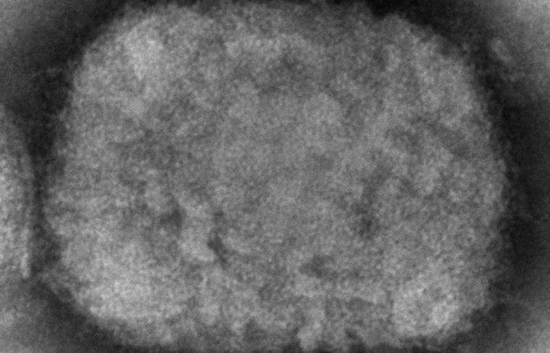 This 2003 electron microscope image made available by the Centers for Disease Control and Prevention shows a monkeypox virion, obtained from a sample associated with the 2003 prairie dog outbreak. Monkeypox, a disease that rarely appears outside Africa, has been identified by European and American health authorities in recent days. (Cynthia S. Goldsmith, Russell Regner/CDC via AP)
